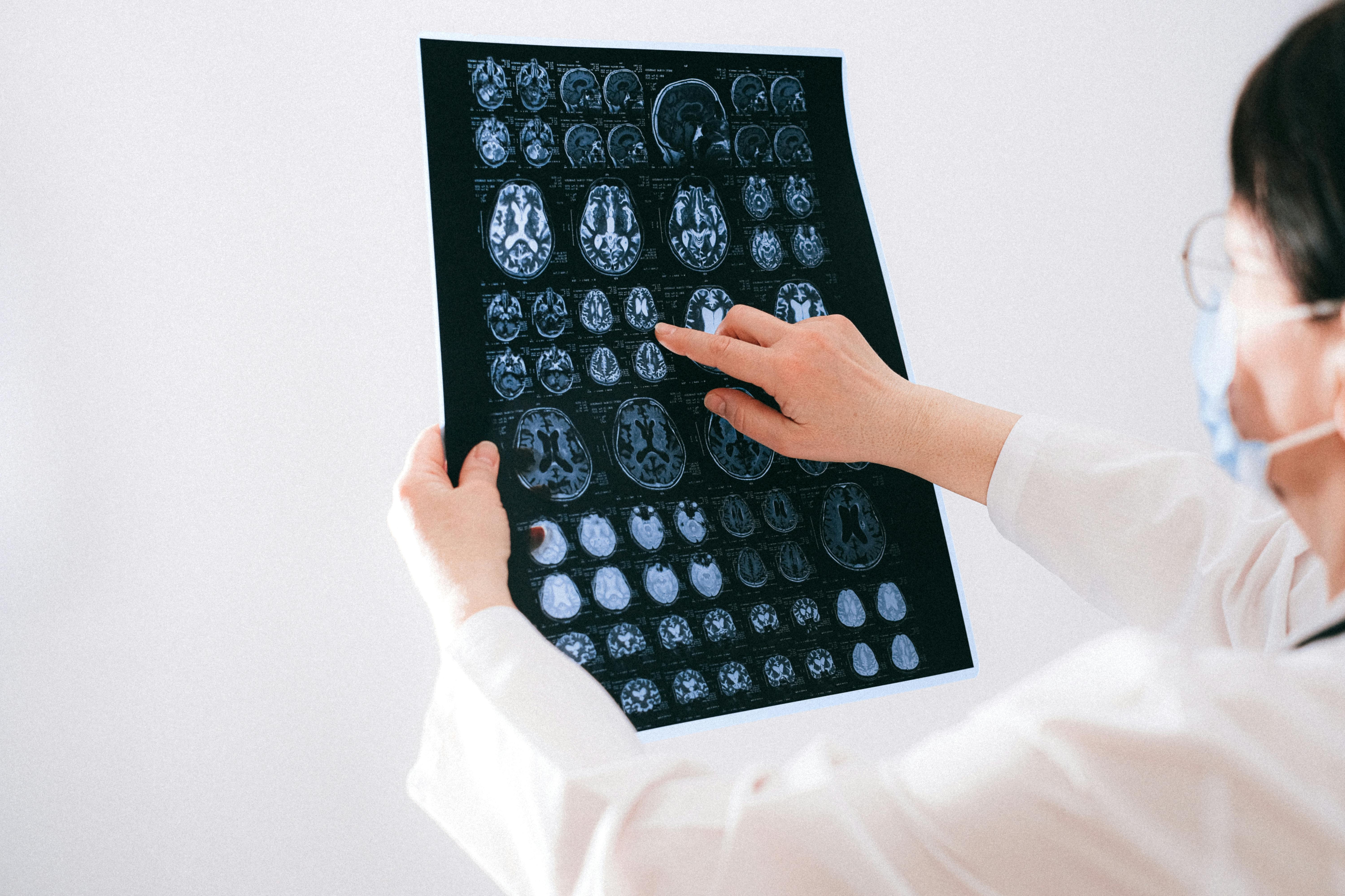 Doctor pointing to an MRI scan of the brain