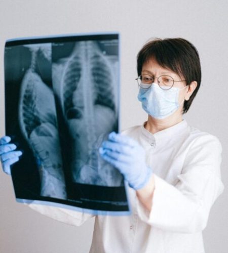 A doctor looking at an -ray